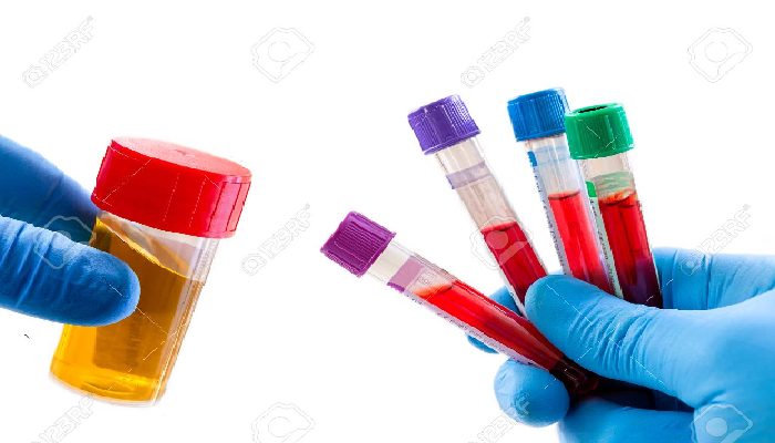 Blood And Urine Test