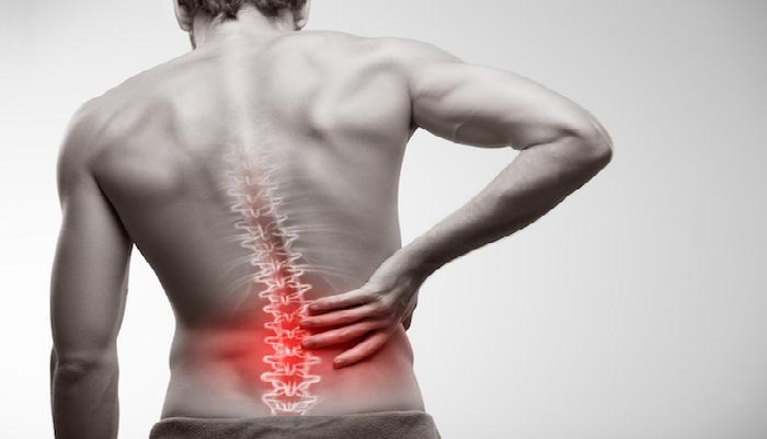 What is a Slipped Disc